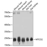 Western Blot - Anti-MTCO2 Antibody (A80542) - Antibodies.com