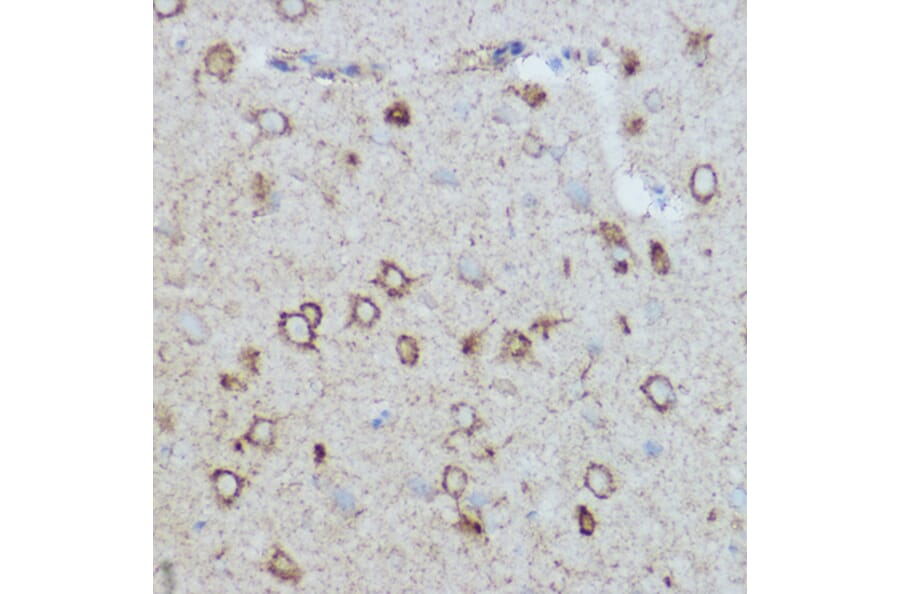 Immunohistochemistry - Anti-MTCO2 Antibody (A80542) - Antibodies.com