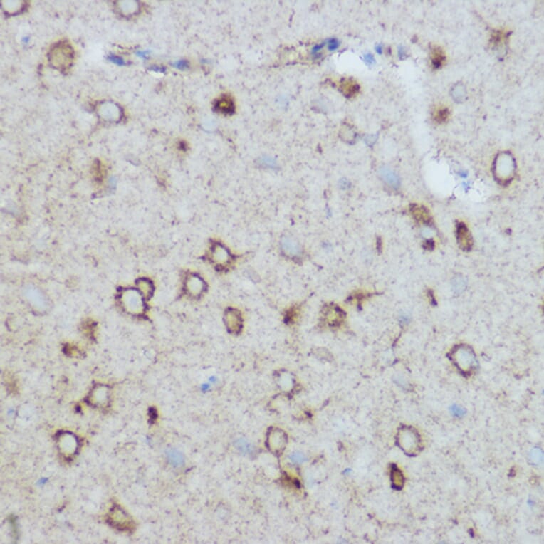 Immunohistochemistry - Anti-MTCO2 Antibody (A80542) - Antibodies.com