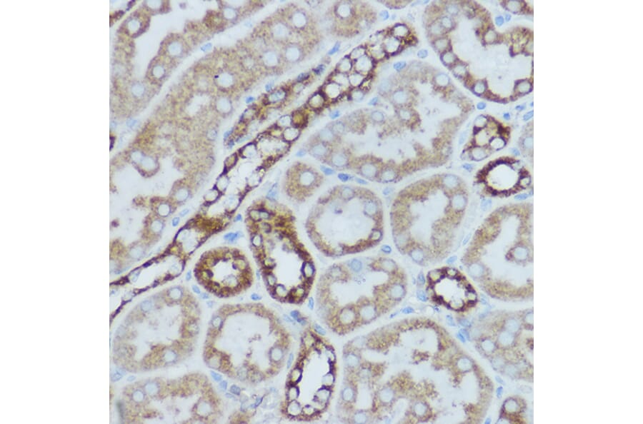 Immunohistochemistry - Anti-MTCO2 Antibody (A80542) - Antibodies.com