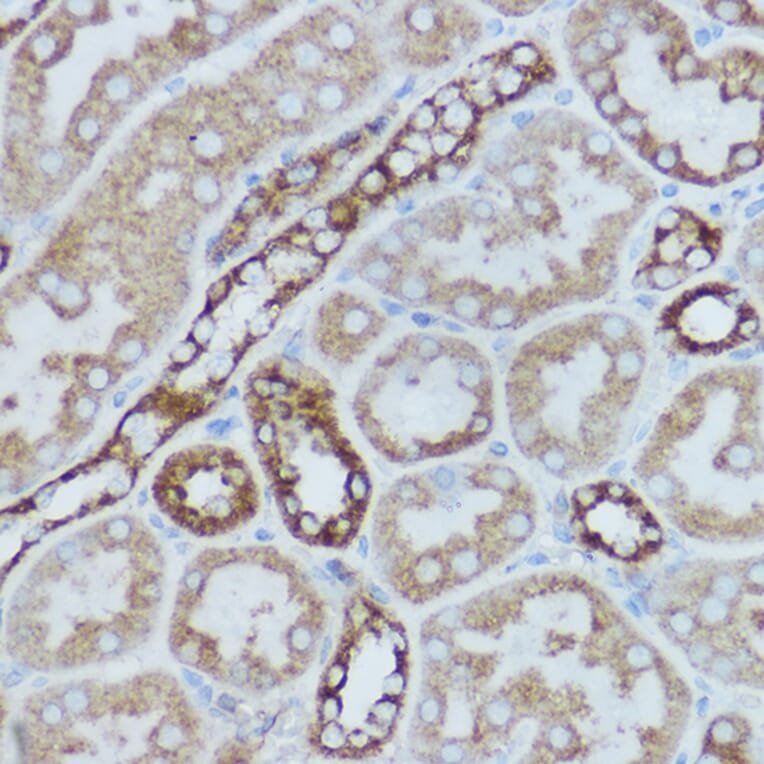 Immunohistochemistry - Anti-MTCO2 Antibody (A80542) - Antibodies.com