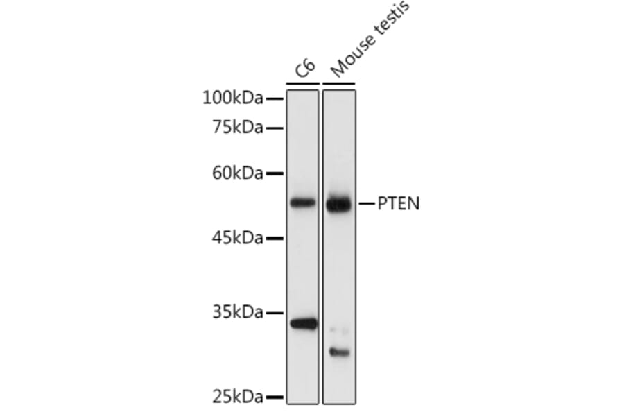 Western Blot - Anti-PTEN Antibody (A80543) - Antibodies.com