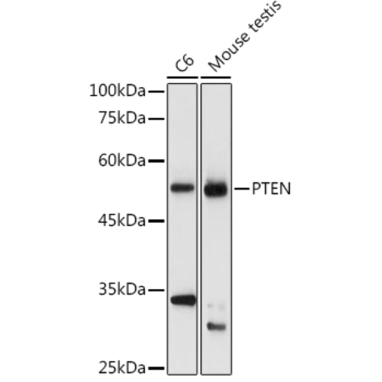 Western Blot - Anti-PTEN Antibody (A80543) - Antibodies.com