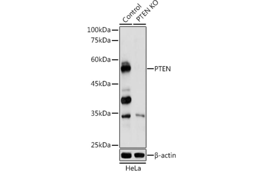Western Blot - Anti-PTEN Antibody (A80543) - Antibodies.com