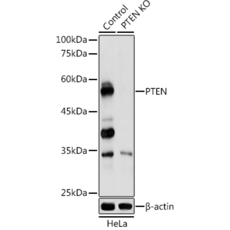 Western Blot - Anti-PTEN Antibody (A80543) - Antibodies.com