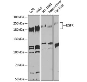 Western Blot - Anti-EGFR Antibody (A80544) - Antibodies.com
