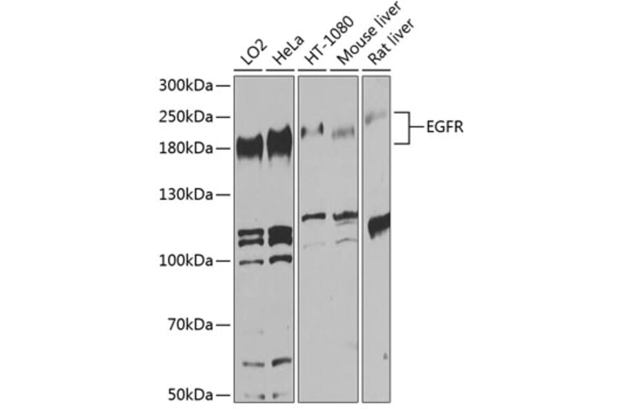 Western Blot - Anti-EGFR Antibody (A80544) - Antibodies.com