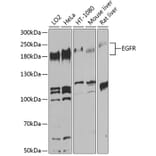 Western Blot - Anti-EGFR Antibody (A80544) - Antibodies.com