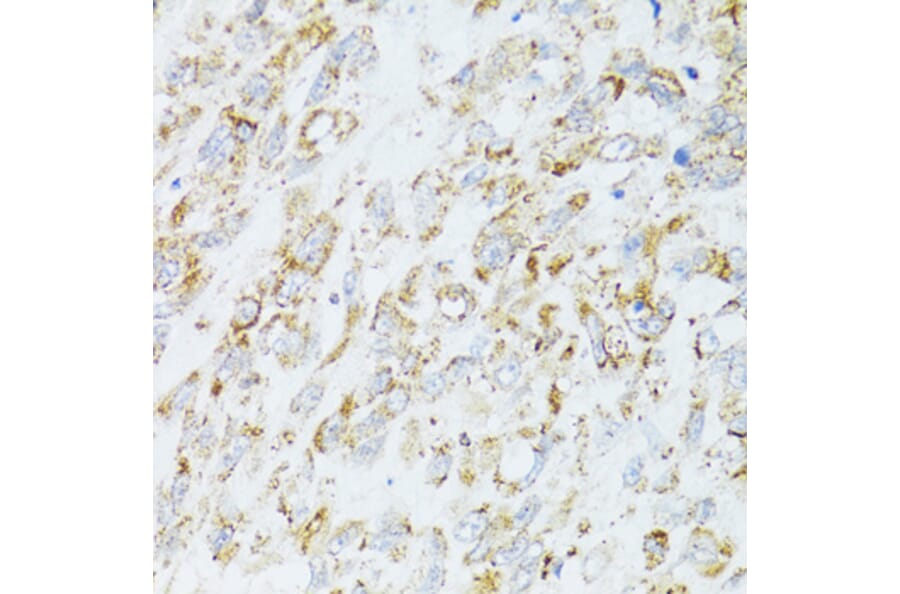 Immunohistochemistry - Anti-EGFR Antibody (A80544) - Antibodies.com