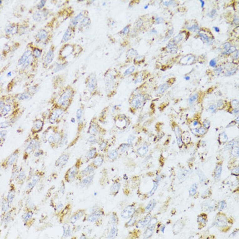 Immunohistochemistry - Anti-EGFR Antibody (A80544) - Antibodies.com