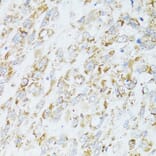 Immunohistochemistry - Anti-EGFR Antibody (A80544) - Antibodies.com