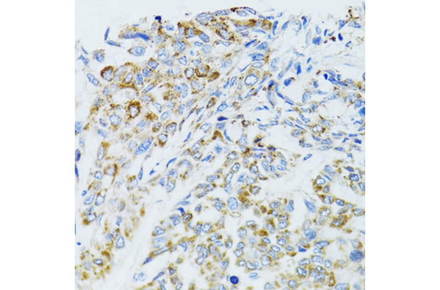 Immunohistochemistry - Anti-EGFR Antibody (A80544) - Antibodies.com