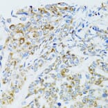 Immunohistochemistry - Anti-EGFR Antibody (A80544) - Antibodies.com