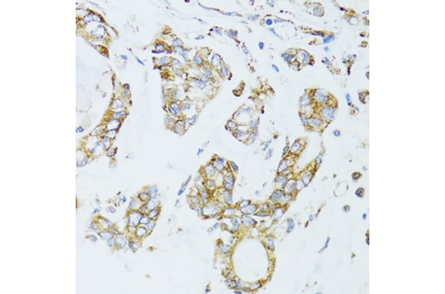 Immunohistochemistry - Anti-EGFR Antibody (A80544) - Antibodies.com