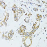 Immunohistochemistry - Anti-EGFR Antibody (A80544) - Antibodies.com