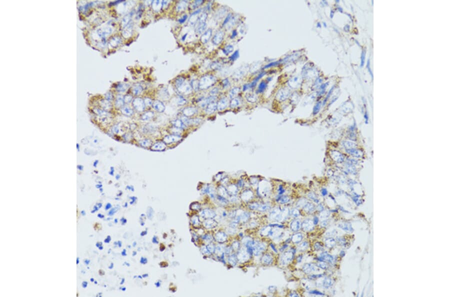 Immunohistochemistry - Anti-EGFR Antibody (A80544) - Antibodies.com
