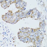 Immunohistochemistry - Anti-EGFR Antibody (A80544) - Antibodies.com