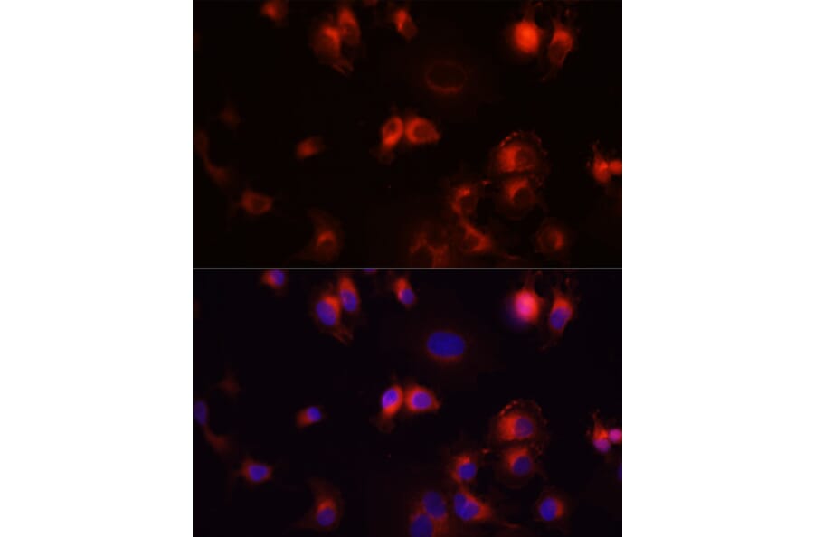 Immunofluorescence - Anti-EGFR Antibody (A80544) - Antibodies.com