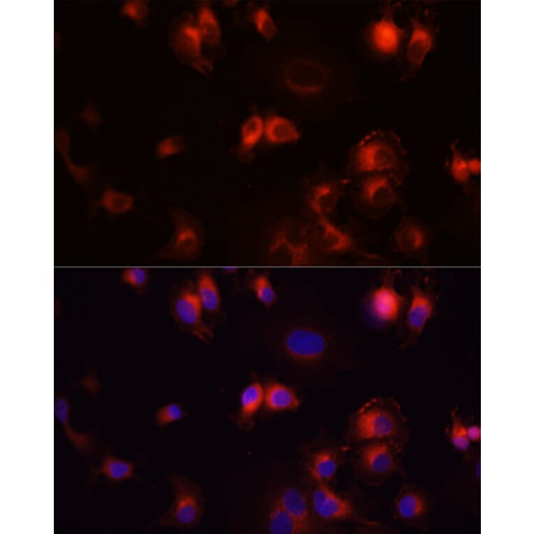 Immunofluorescence - Anti-EGFR Antibody (A80544) - Antibodies.com