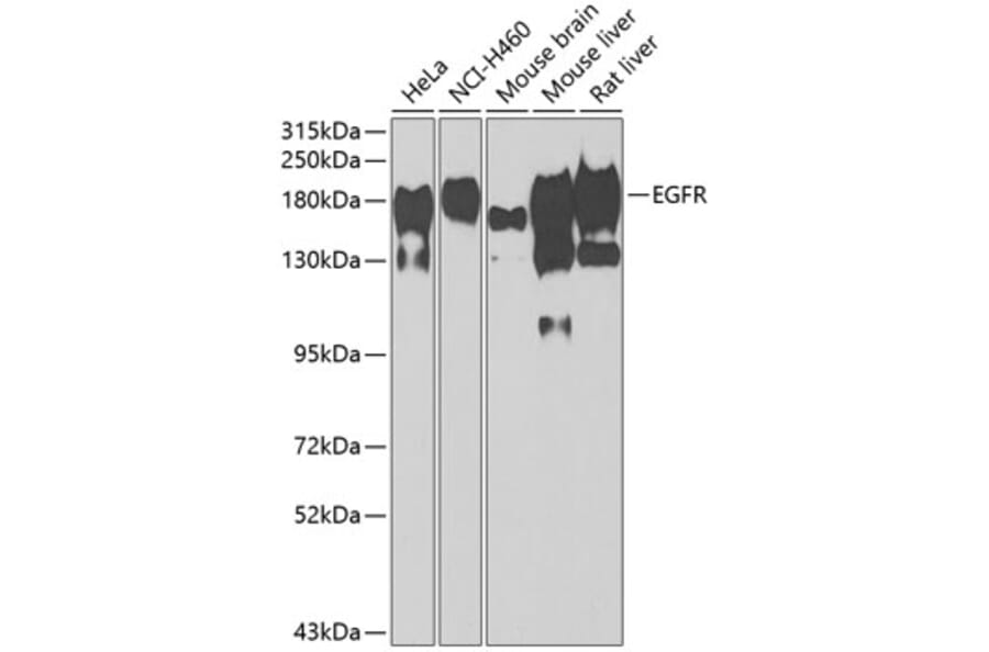 Western Blot - Anti-EGFR Antibody (A11576) - Antibodies.com