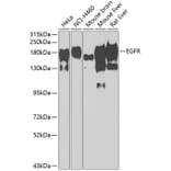 Western Blot - Anti-EGFR Antibody (A11576) - Antibodies.com