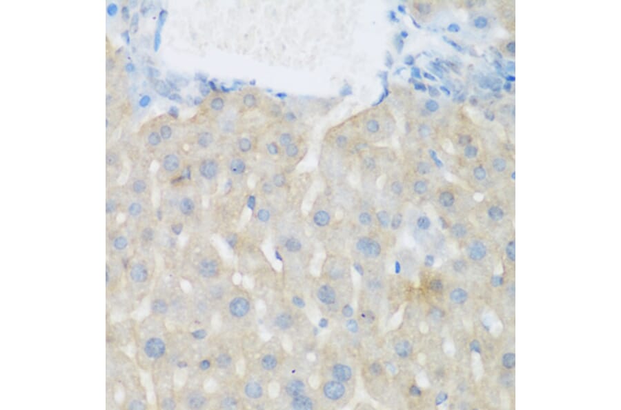 Immunohistochemistry - Anti-EGFR Antibody (A11576) - Antibodies.com