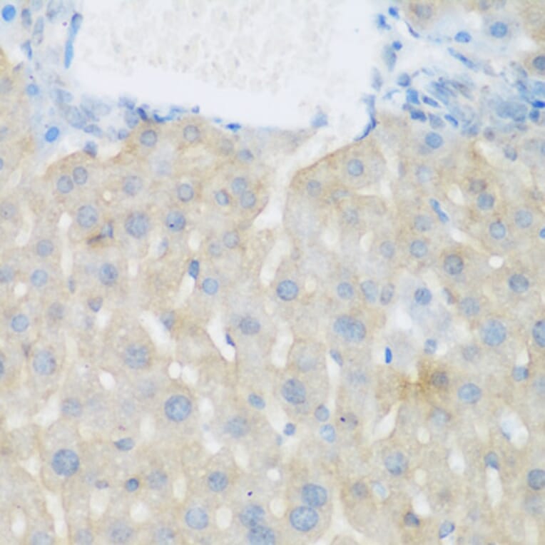 Immunohistochemistry - Anti-EGFR Antibody (A11576) - Antibodies.com