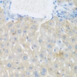 Immunohistochemistry - Anti-EGFR Antibody (A11576) - Antibodies.com