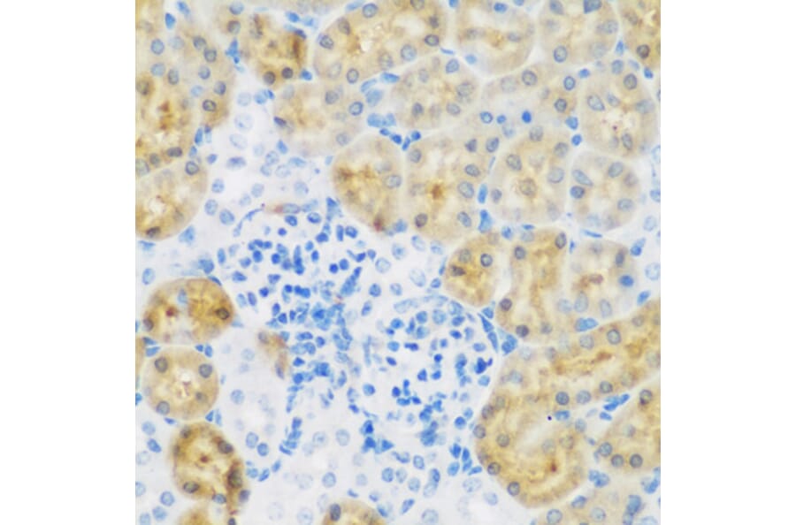 Immunohistochemistry - Anti-EGFR Antibody (A11576) - Antibodies.com