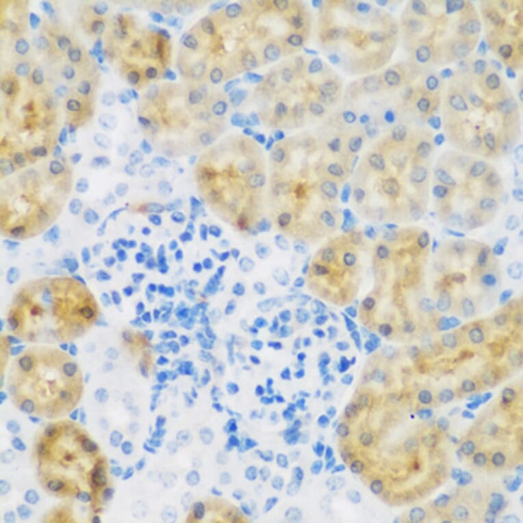 Immunohistochemistry - Anti-EGFR Antibody (A11576) - Antibodies.com