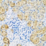 Immunohistochemistry - Anti-EGFR Antibody (A11576) - Antibodies.com