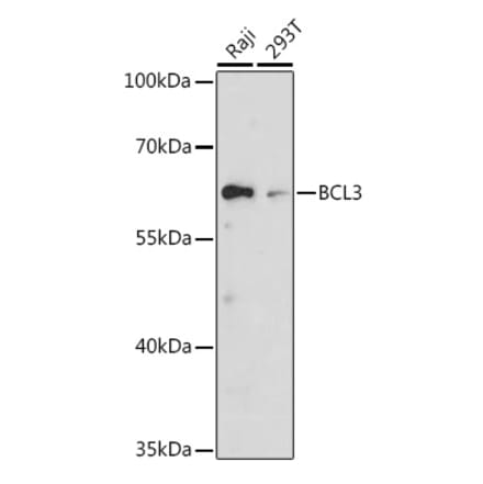 Western Blot - Anti-Bcl3 Antibody (A80546) - Antibodies.com