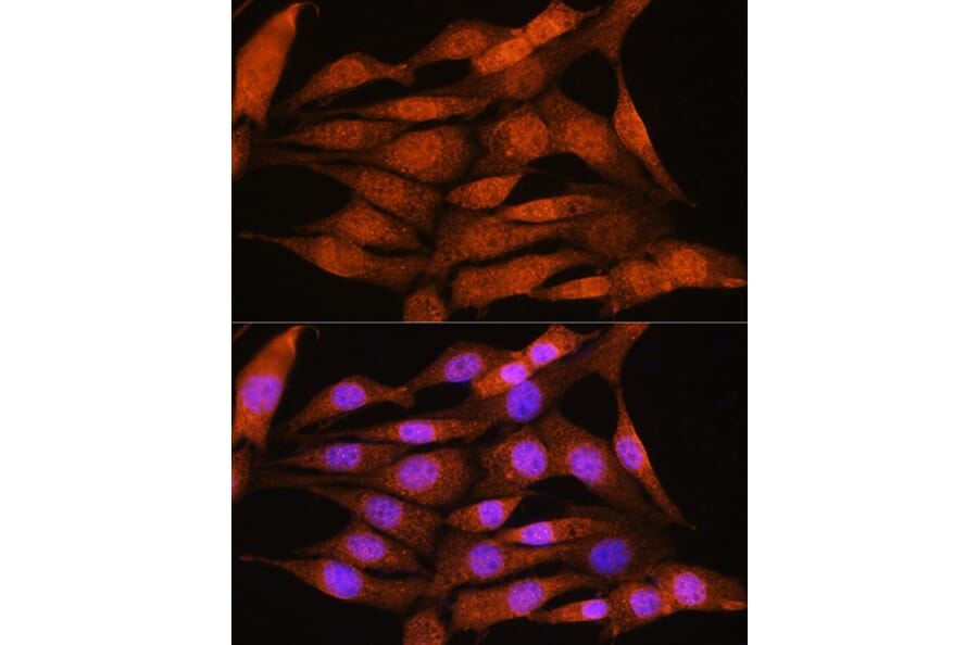 Immunofluorescence - Anti-Bcl3 Antibody (A80546) - Antibodies.com