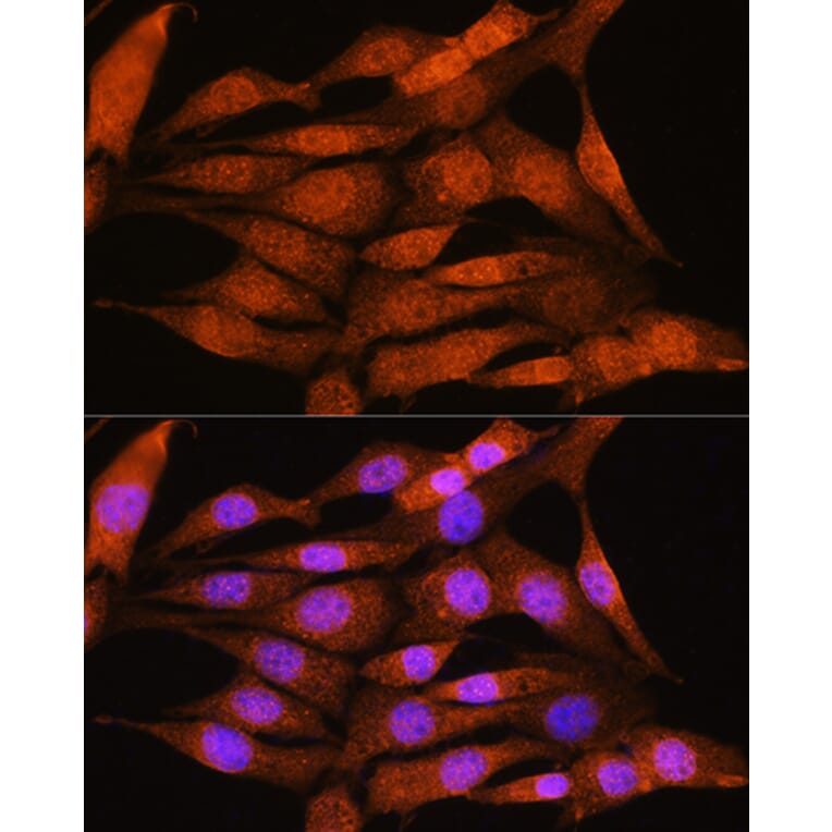 Immunofluorescence - Anti-Bcl3 Antibody (A80546) - Antibodies.com