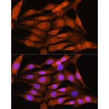 Immunofluorescence - Anti-Bcl3 Antibody (A80546) - Antibodies.com
