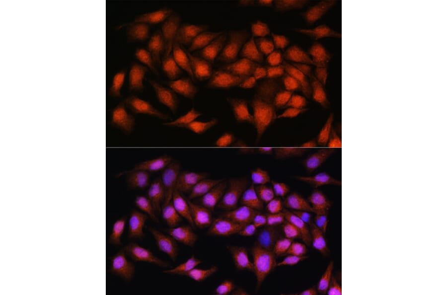Immunofluorescence - Anti-Bcl3 Antibody (A80546) - Antibodies.com