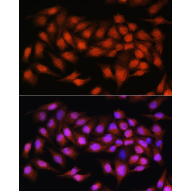 Immunofluorescence - Anti-Bcl3 Antibody (A80546) - Antibodies.com