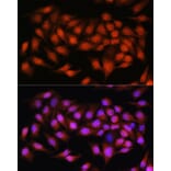 Immunofluorescence - Anti-Bcl3 Antibody (A80546) - Antibodies.com