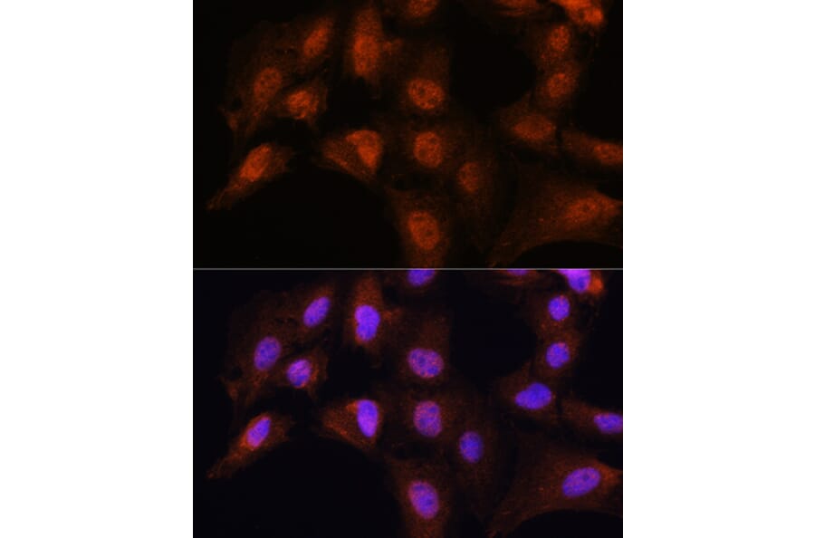 Immunofluorescence - Anti-Bcl3 Antibody (A80546) - Antibodies.com