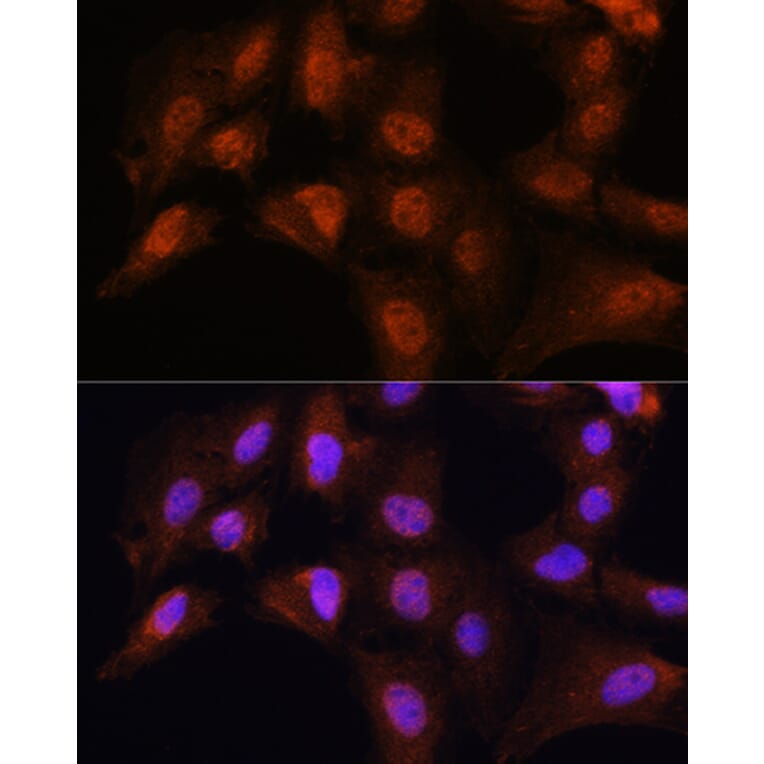 Immunofluorescence - Anti-Bcl3 Antibody (A80546) - Antibodies.com