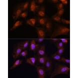 Immunofluorescence - Anti-Bcl3 Antibody (A80546) - Antibodies.com