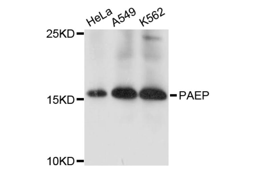 Western Blot - Anti-PAEP Antibody (A11810) - Antibodies.com