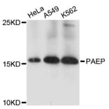 Western Blot - Anti-PAEP Antibody (A11810) - Antibodies.com
