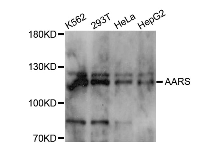 Western Blot - Anti-AARS Antibody (A11846) - Antibodies.com