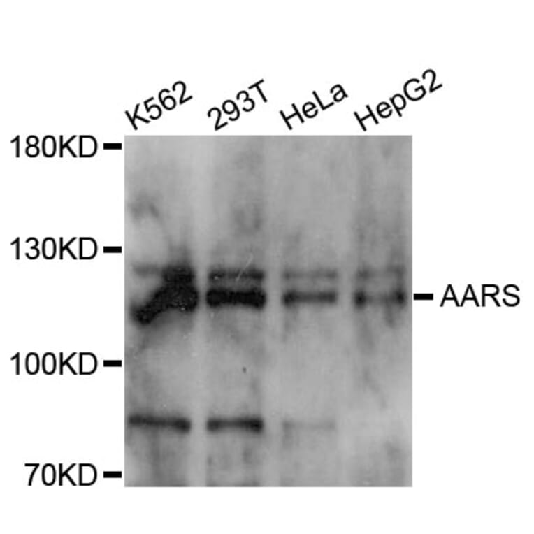Western Blot - Anti-AARS Antibody (A11846) - Antibodies.com