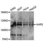 Western Blot - Anti-AARS Antibody (A11846) - Antibodies.com