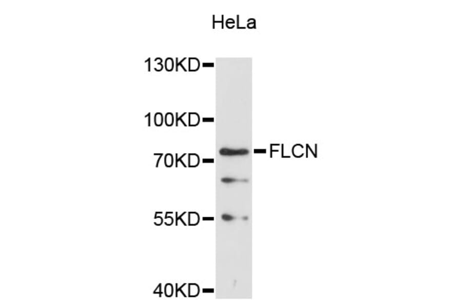 Western Blot - Anti-FLCN Antibody (A11849) - Antibodies.com