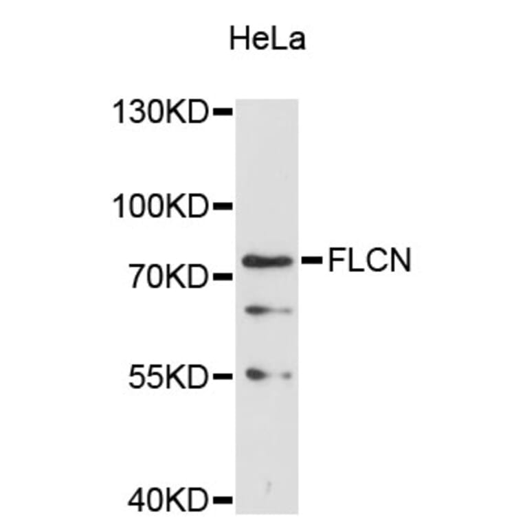 Western Blot - Anti-FLCN Antibody (A11849) - Antibodies.com