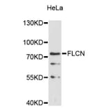 Western Blot - Anti-FLCN Antibody (A11849) - Antibodies.com