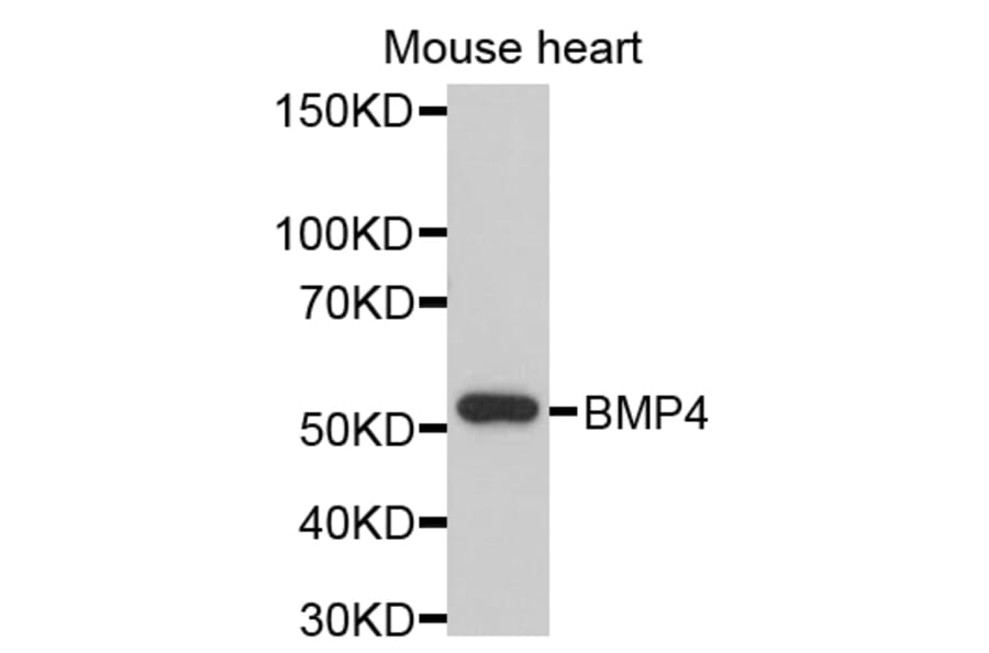 Western Blot - Anti-BMP4 Antibody (A11922) - Antibodies.com